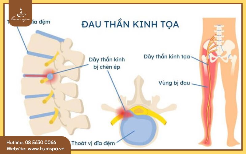 au-thn-kinh-ta -2.jpg