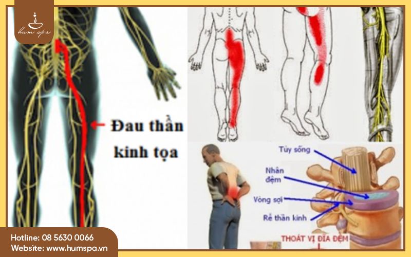 au-thn-kinh-ta -4.jpg