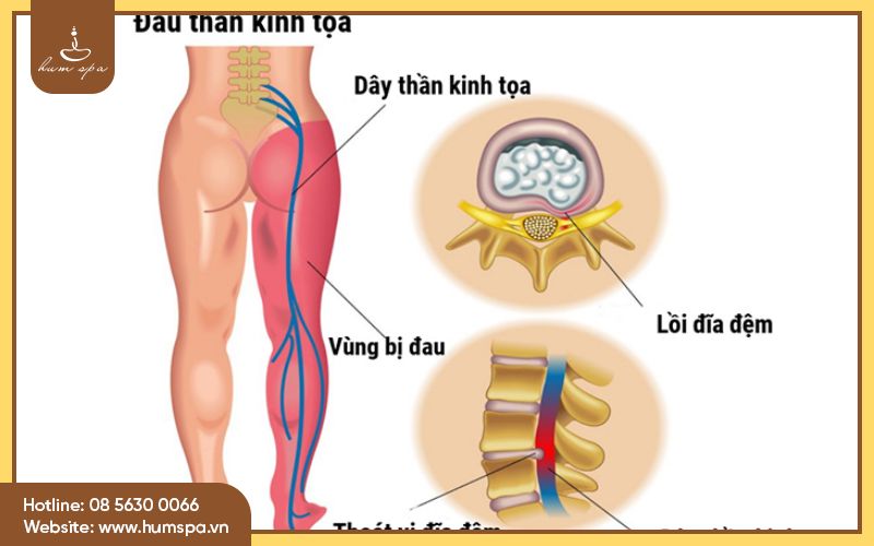 au-thn-kinh-ta .jpg
