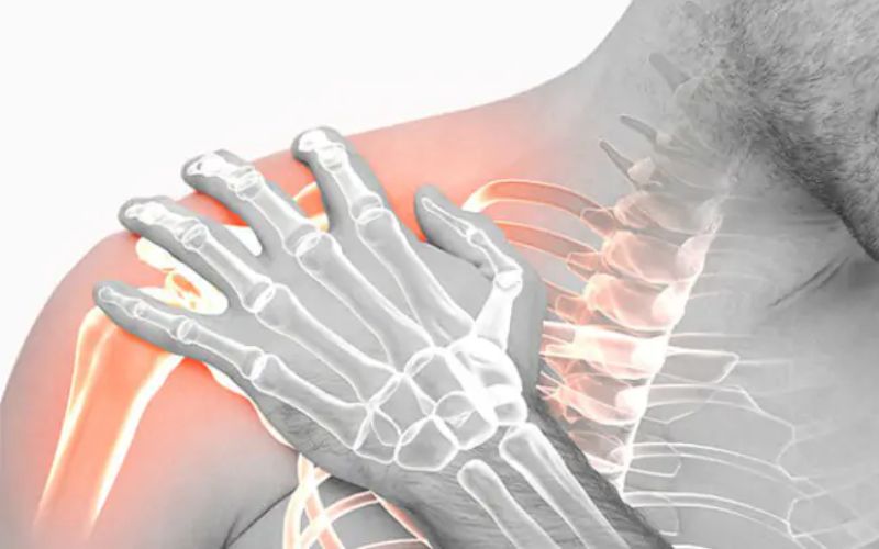 Trấn thương vùng vai