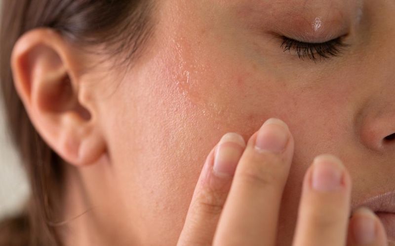 Rửa mặt xong bị khô có sao không?
