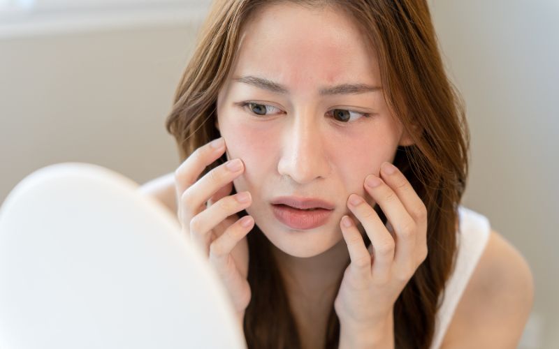 Da khô, bị kích ứng và nổi mẩn đỏ